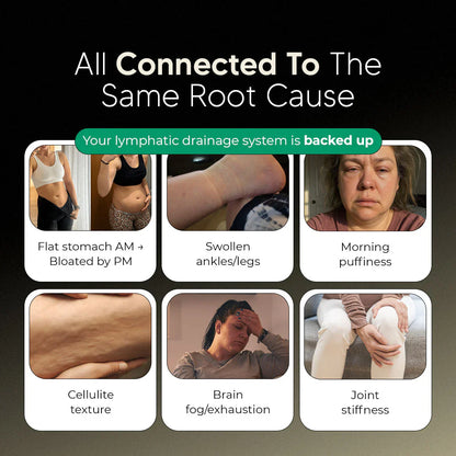 New Maximum Potency Formula - Lymphatic Drainage Drops by Sala Health™